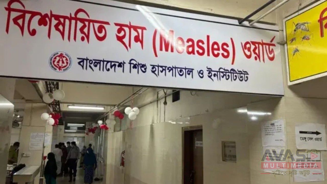 হাম উপসর্গে আরও ৩ শিশুর মৃত্যু, ২৪ ঘণ্টায় আক্রান্ত ১ হাজার ৬৩ 